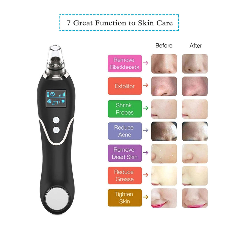 Hot Cold Blackhead Remover Vacuum