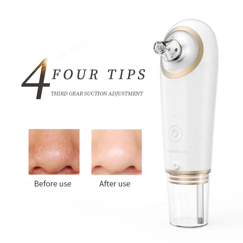 Small Bubble Blackhead Remover - Deep Cleansing Beauty Device - MyHabun