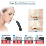 Hot Cold Blackhead Remover Vacuum